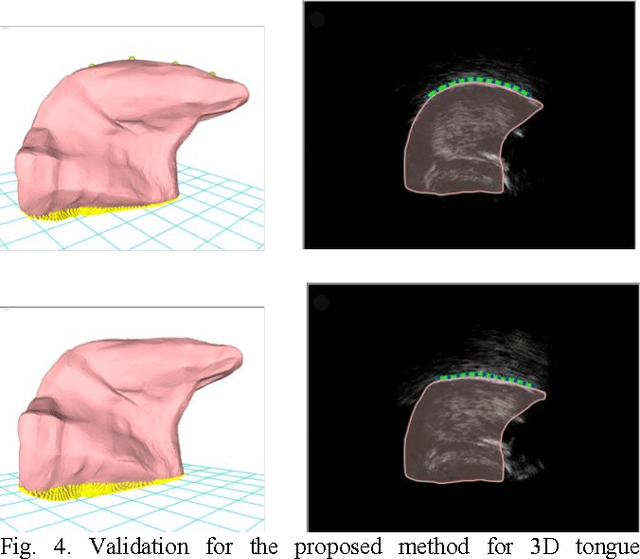 Figure 4 for Contour-based 3d tongue motion visualization using ultrasound image sequences