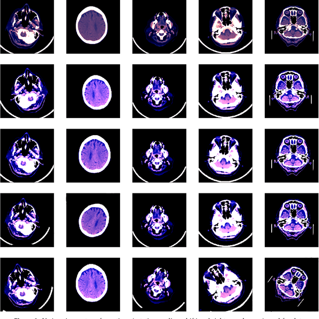 Figure 3 for Accurate and Efficient Intracranial Hemorrhage Detection and Subtype Classification in 3D CT Scans with Convolutional and Long Short-Term Memory Neural Networks