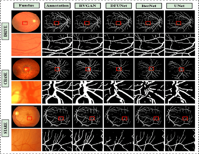 Figure 1 for RV-GAN : Retinal Vessel Segmentation from Fundus Images using Multi-scale Generative Adversarial Networks