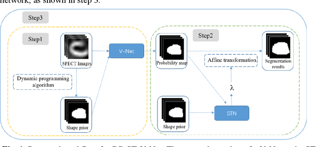 Figure 1 for A new method incorporating deep learning with shape priors for left ventricular segmentation in myocardial perfusion SPECT images