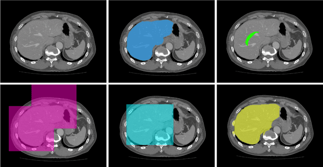 Figure 1 for Employing Weak Annotations for Medical Image Analysis Problems