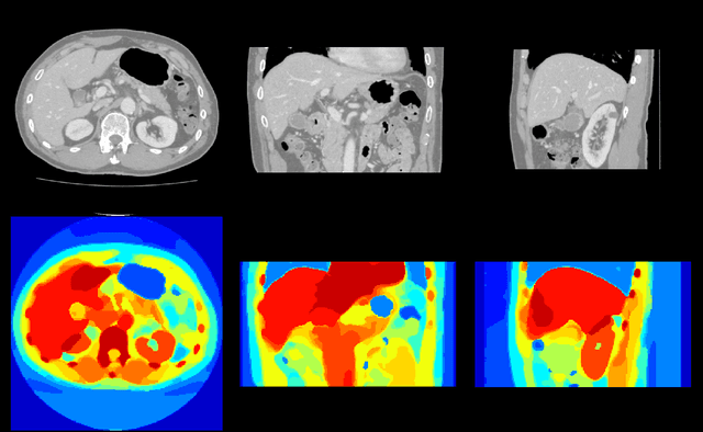 Figure 2 for Employing Weak Annotations for Medical Image Analysis Problems