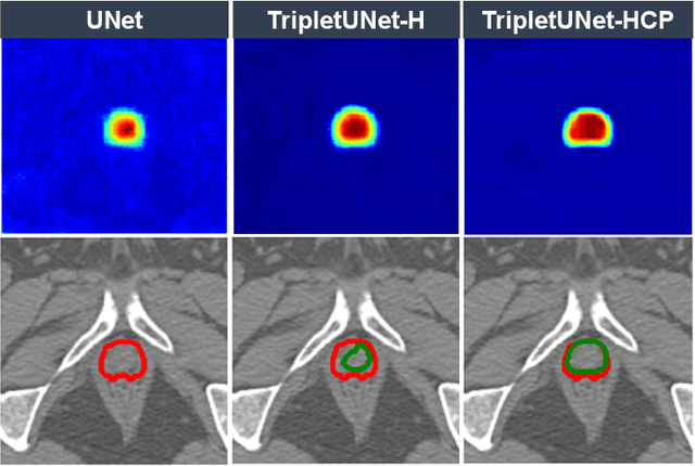 Figure 1 for TripletUNet: Multi-Task U-Net with Online Voxel-Wise Learning for Precise CT Prostate Segmentation