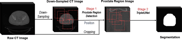 Figure 4 for TripletUNet: Multi-Task U-Net with Online Voxel-Wise Learning for Precise CT Prostate Segmentation