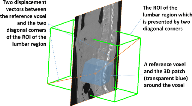 Figure 3 for Fully Automatic Segmentation of Lumbar Vertebrae from CT Images using Cascaded 3D Fully Convolutional Networks
