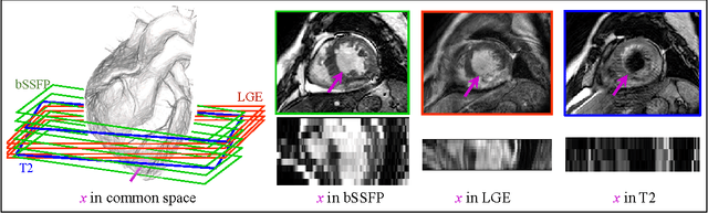 Figure 1 for Multivariate mixture model for myocardium segmentation combining multi-source images