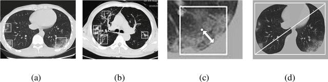 Figure 4 for Deep Learning System to Screen Coronavirus Disease 2019 Pneumonia