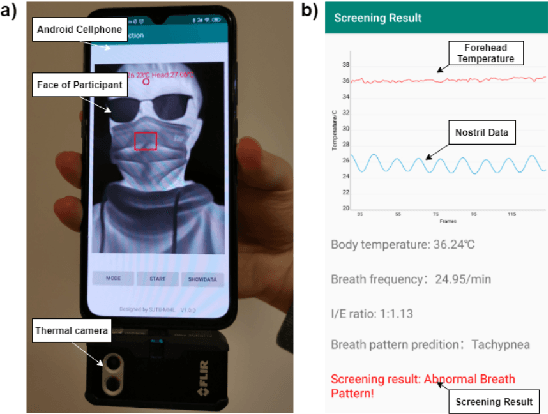 Figure 1 for Combining Visible Light and Infrared Imaging for Efficient Detection of Respiratory Infections such as COVID-19 on Portable Device