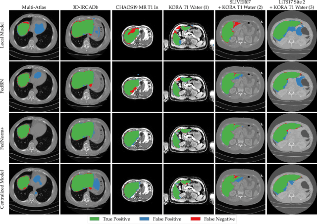 Figure 4 for FedNorm: Modality-Based Normalization in Federated Learning for Multi-Modal Liver Segmentation