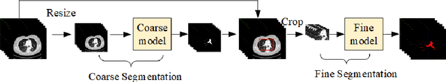 Figure 2 for A multi view multi stage and multi window framework for pulmonary artery segmentation from CT scans
