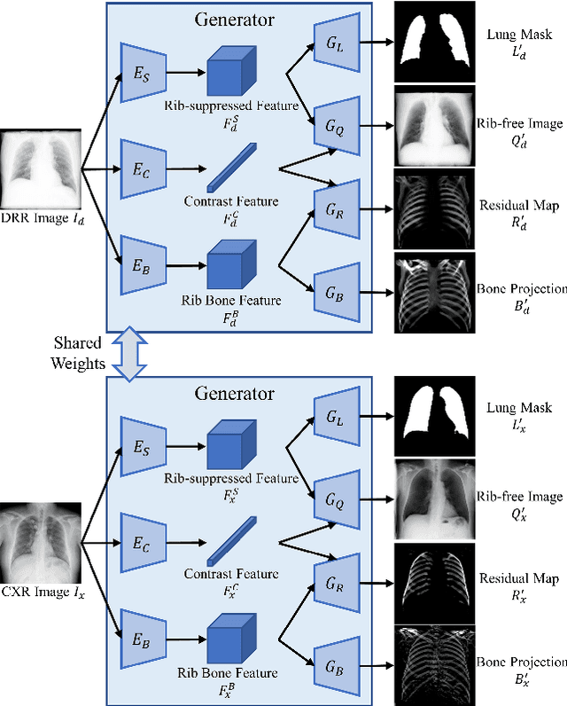 Figure 3 for GAN-based disentanglement learning for chest X-ray rib suppression