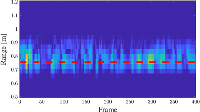 Figure 3 for Radar-based Respiratory Rate Monitoring in Standing Position