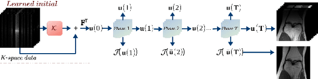 Figure 2 for An Optimal Control Framework for Joint-channel Parallel MRI Reconstruction without Coil Sensitivities