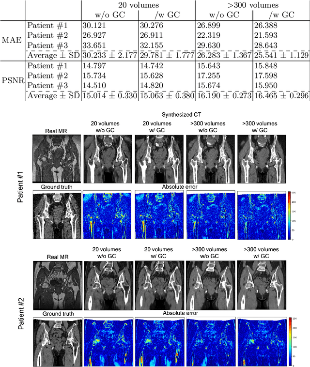 Figure 2 for Cross-modality image synthesis from unpaired data using CycleGAN: Effects of gradient consistency loss and training data size