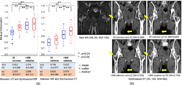 Figure 4 for Cross-modality image synthesis from unpaired data using CycleGAN: Effects of gradient consistency loss and training data size