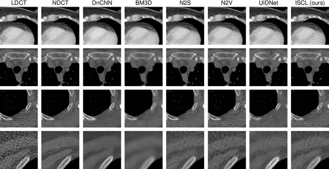 Figure 4 for ISCL: Interdependent Self-Cooperative Learning for Unpaired Image Denoising