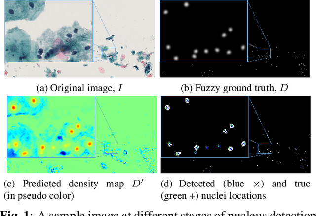 Figure 1 for A Deep Learning based Pipeline for Efficient Oral Cancer Screening on Whole Slide Images