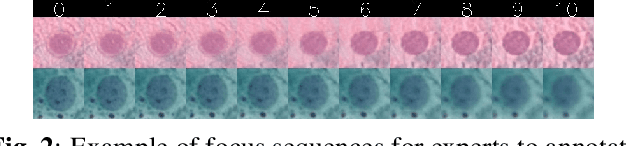 Figure 3 for A Deep Learning based Pipeline for Efficient Oral Cancer Screening on Whole Slide Images