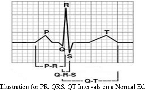 Figure 2 for Arrhythmia Detection using Mutual Information-Based Integration Method
