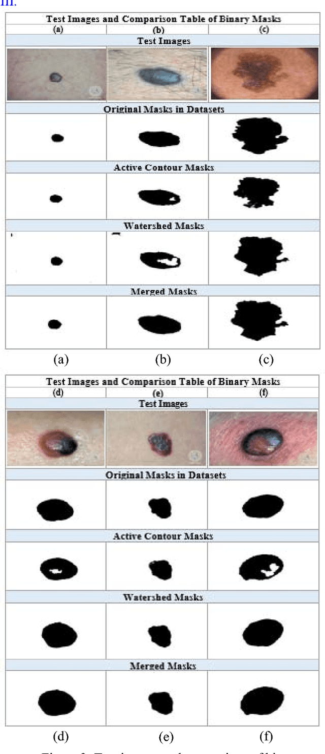 Figure 2 for Automatic Lesion Detection System (ALDS) for Skin Cancer Classification Using SVM and Neural Classifiers