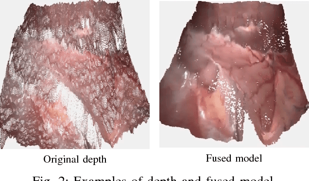 Figure 2 for MIS-SLAM: Real-time Large Scale Dense Deformable SLAM System in Minimal Invasive Surgery Based on Heterogeneous Computing