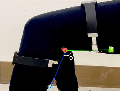 Figure 3 for Range of Motion Sensors for Monitoring Recovery of Total Knee Arthroplasty