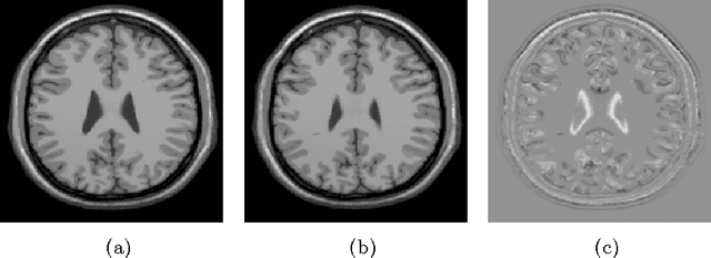 Figure 3 for Fast Mesh-Based Medical Image Registration