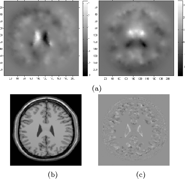 Figure 4 for Fast Mesh-Based Medical Image Registration