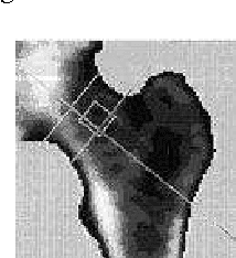 Figure 1 for lambda-Connectedness Determination for Image Segmentation