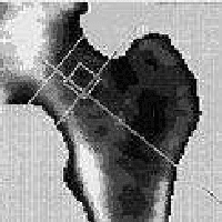 Figure 2 for lambda-Connectedness Determination for Image Segmentation