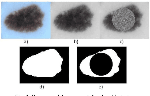 Figure 1 for ISIC 2017 Skin Lesion Segmentation Using Deep Encoder-Decoder Network