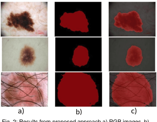 Figure 2 for ISIC 2017 Skin Lesion Segmentation Using Deep Encoder-Decoder Network