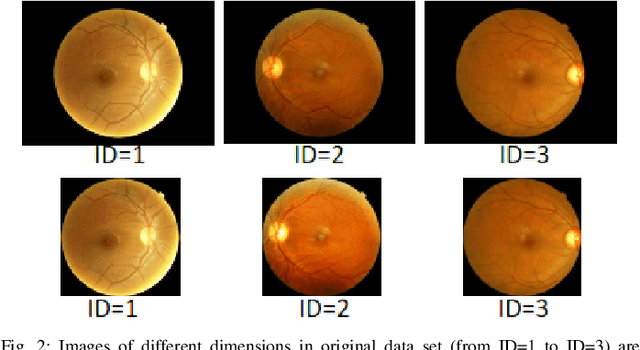 Figure 4 for An Active Learning Method for Diabetic Retinopathy Classification with Uncertainty Quantification