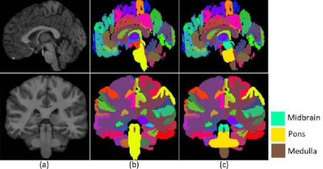 Figure 1 for Automated brainstem parcellation using multi-atlas segmentation and deep neural network