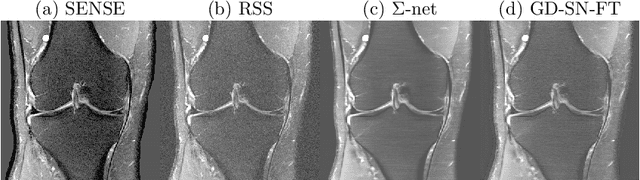 Figure 1 for $Σ$-net: Ensembled Iterative Deep Neural Networks for Accelerated Parallel MR Image Reconstruction