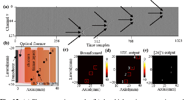 Figure 2 for Simultaneous Denoising and Localization Network for Photoacoustic Target Localization