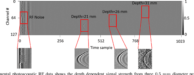 Figure 1 for Simultaneous Denoising and Localization Network for Photoacoustic Target Localization