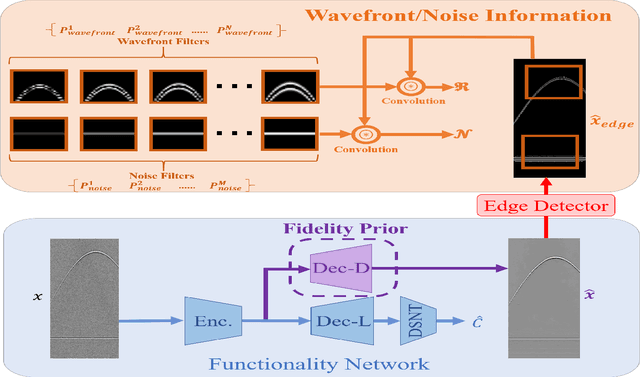 Figure 3 for Simultaneous Denoising and Localization Network for Photoacoustic Target Localization