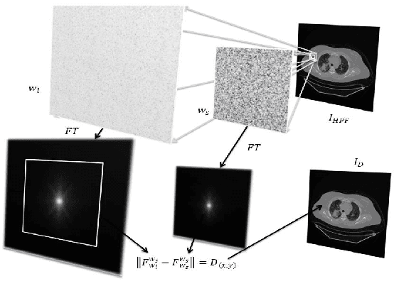 Figure 2 for Automated Selection of Uniform Regions for CT Image Quality Detection