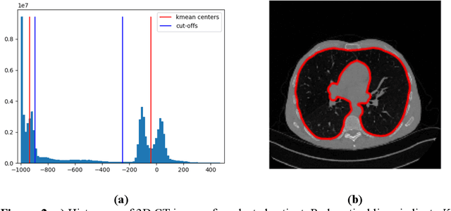 Figure 3 for Quantitative CT texture-based method to predict diagnosis and prognosis of fibrosing interstitial lung disease patterns