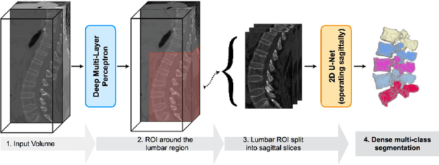 Figure 1 for A Localisation-Segmentation Approach for Multi-label Annotation of Lumbar Vertebrae using Deep Nets