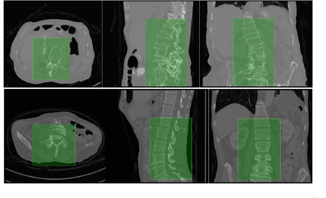 Figure 3 for A Localisation-Segmentation Approach for Multi-label Annotation of Lumbar Vertebrae using Deep Nets