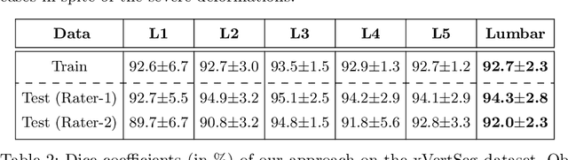 Figure 4 for A Localisation-Segmentation Approach for Multi-label Annotation of Lumbar Vertebrae using Deep Nets