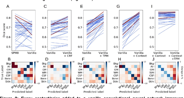 Figure 2 for Tissue segmentation with deep 3D networks and spatial priors