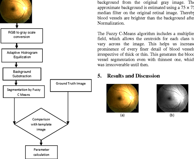 Figure 1 for FCM Based Blood Vessel Segmentation Method for Retinal Images
