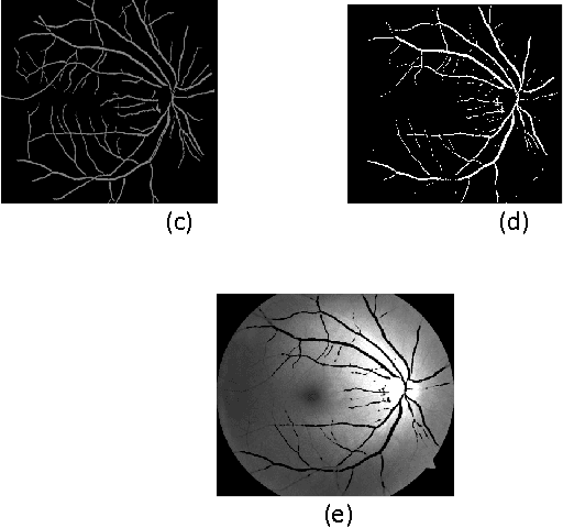 Figure 3 for FCM Based Blood Vessel Segmentation Method for Retinal Images