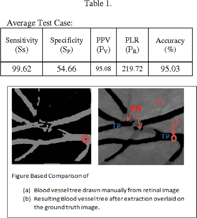 Figure 2 for FCM Based Blood Vessel Segmentation Method for Retinal Images