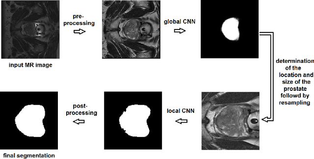 Figure 1 for A deep learning-based method for prostate segmentation in T2-weighted magnetic resonance imaging