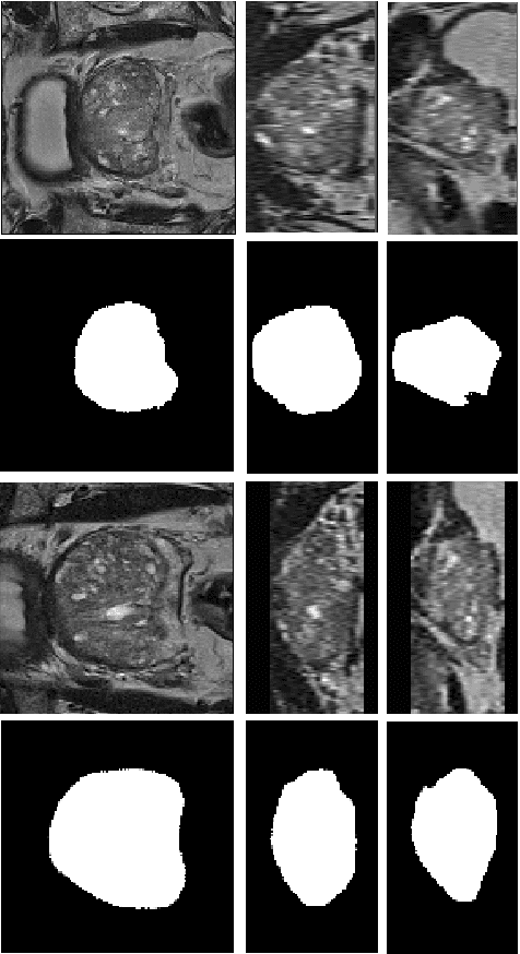 Figure 4 for A deep learning-based method for prostate segmentation in T2-weighted magnetic resonance imaging