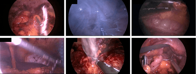 Figure 1 for Segmenting Medical Instruments in Minimally Invasive Surgeries using AttentionMask